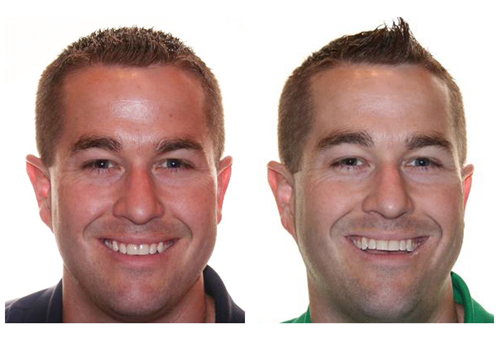 Corona Family Dental