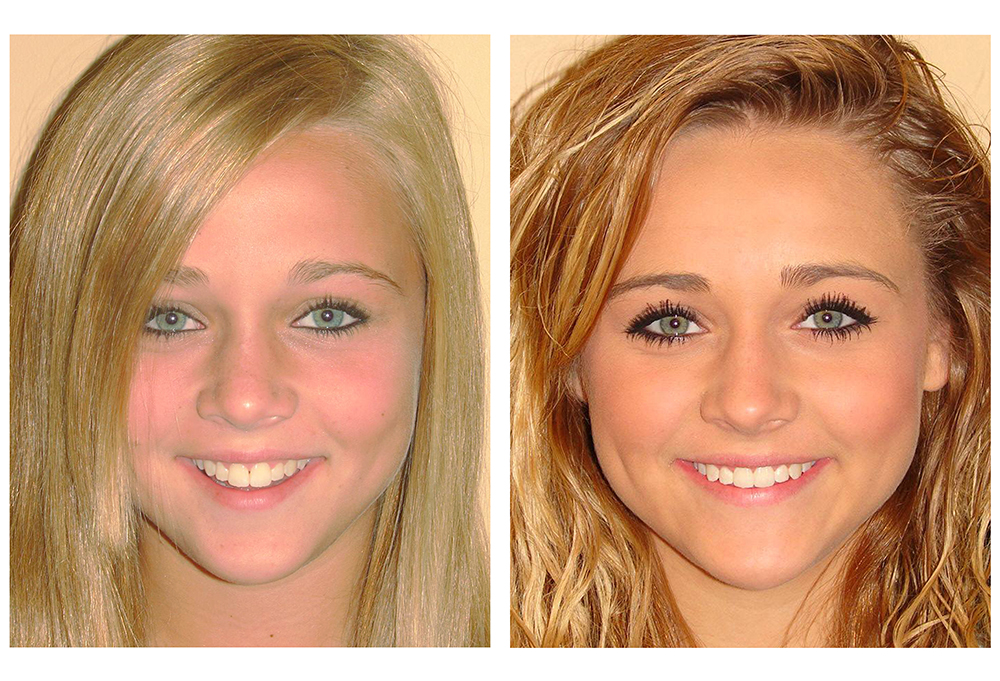 Corona Family Dental