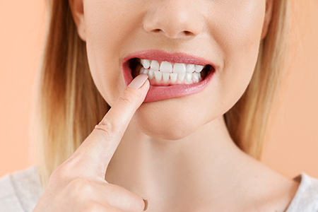 A woman with her finger on her teeth, possibly indicating a dental issue or concern.